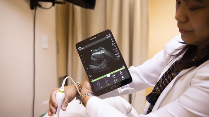 Mission possible: Increasing access to prenatal ultrasound in rural areas with Lumify