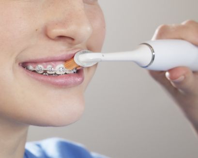Patient with braces brushing top of front braces.