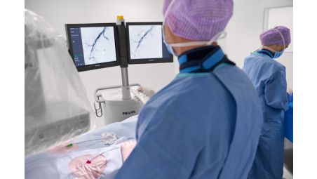 すべての臨床現場に対応する次世代フラットディテクタ