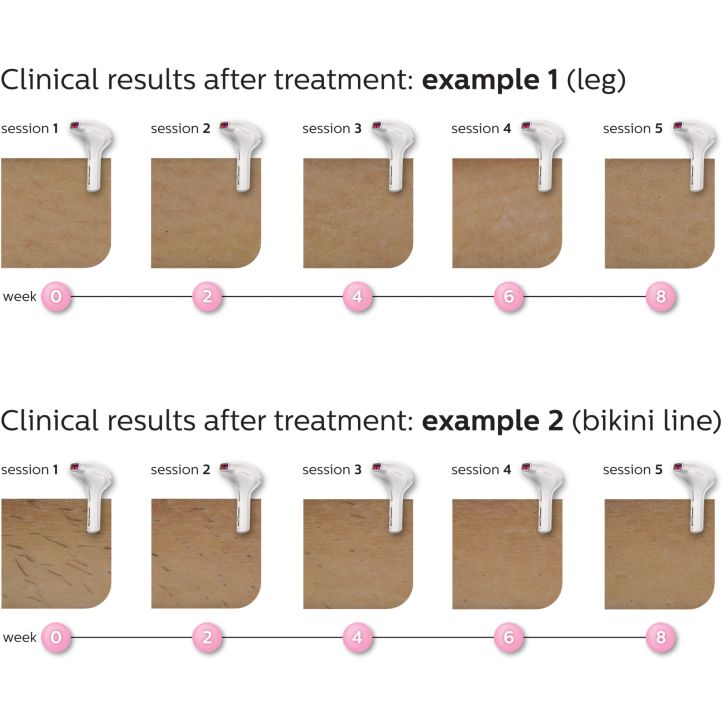 Feel continuously hair free*