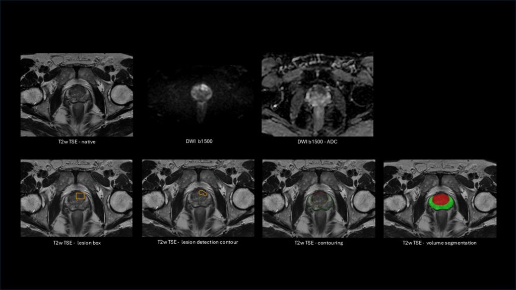 Smart Reading QP-prostate - overview of images in the report
