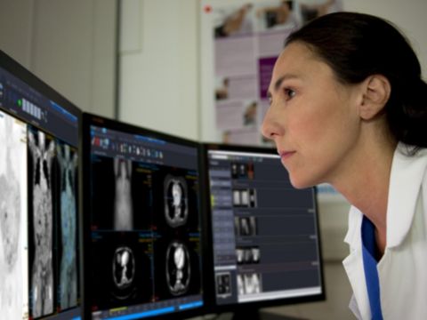 A radiologist looks at scans from Philips radiology software on a computer screen