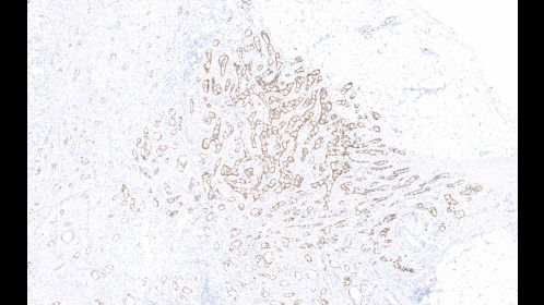 Image clinique et anatomopathologie numérique