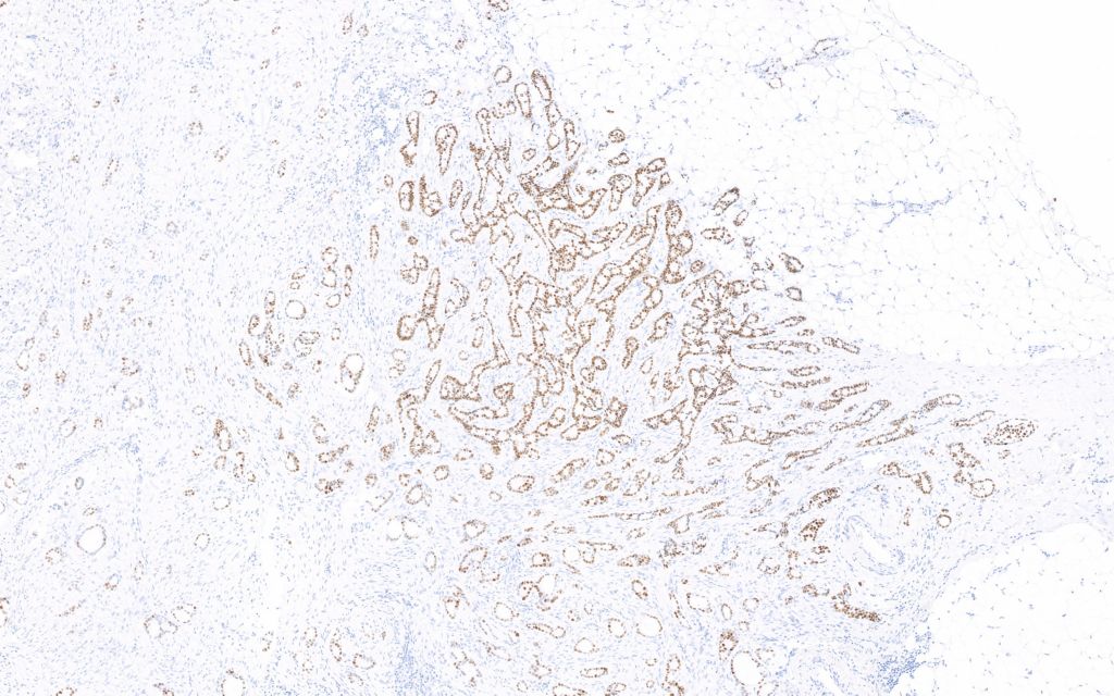 Clinical image digital pathology