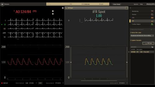 User interface - iFR exam room