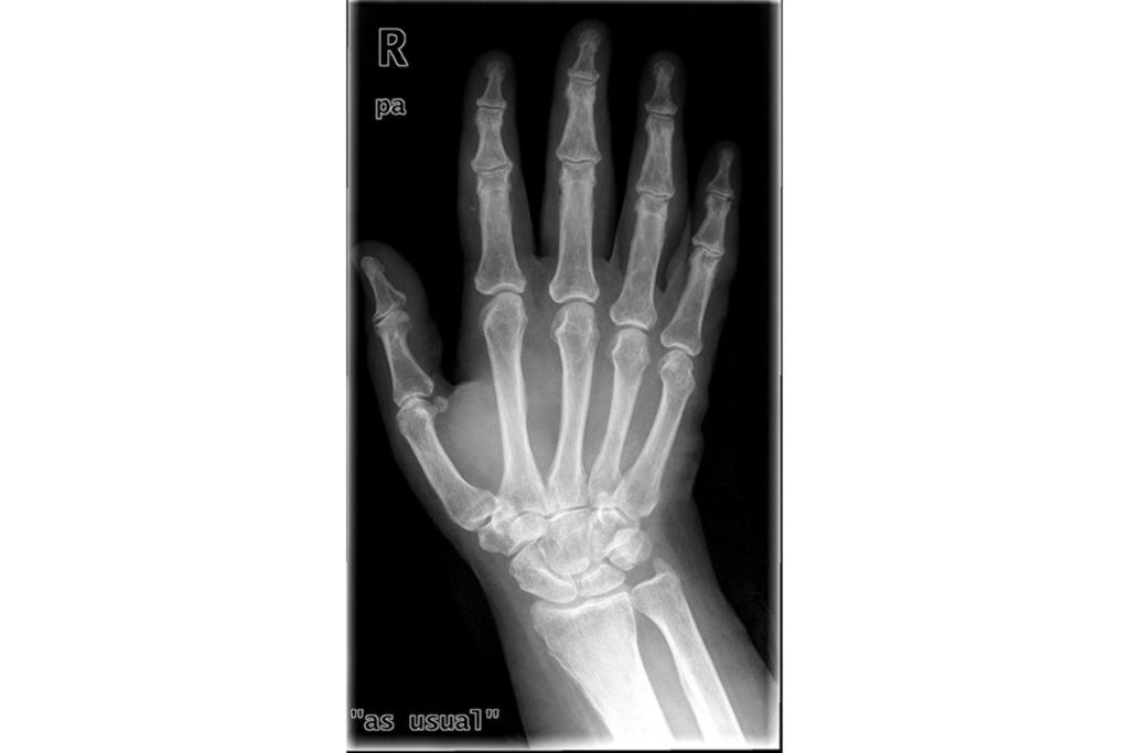 Hidden details revealed