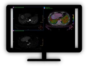 CT Multiphase Analysis Visualization of enhancement differences of multi-phase CT data