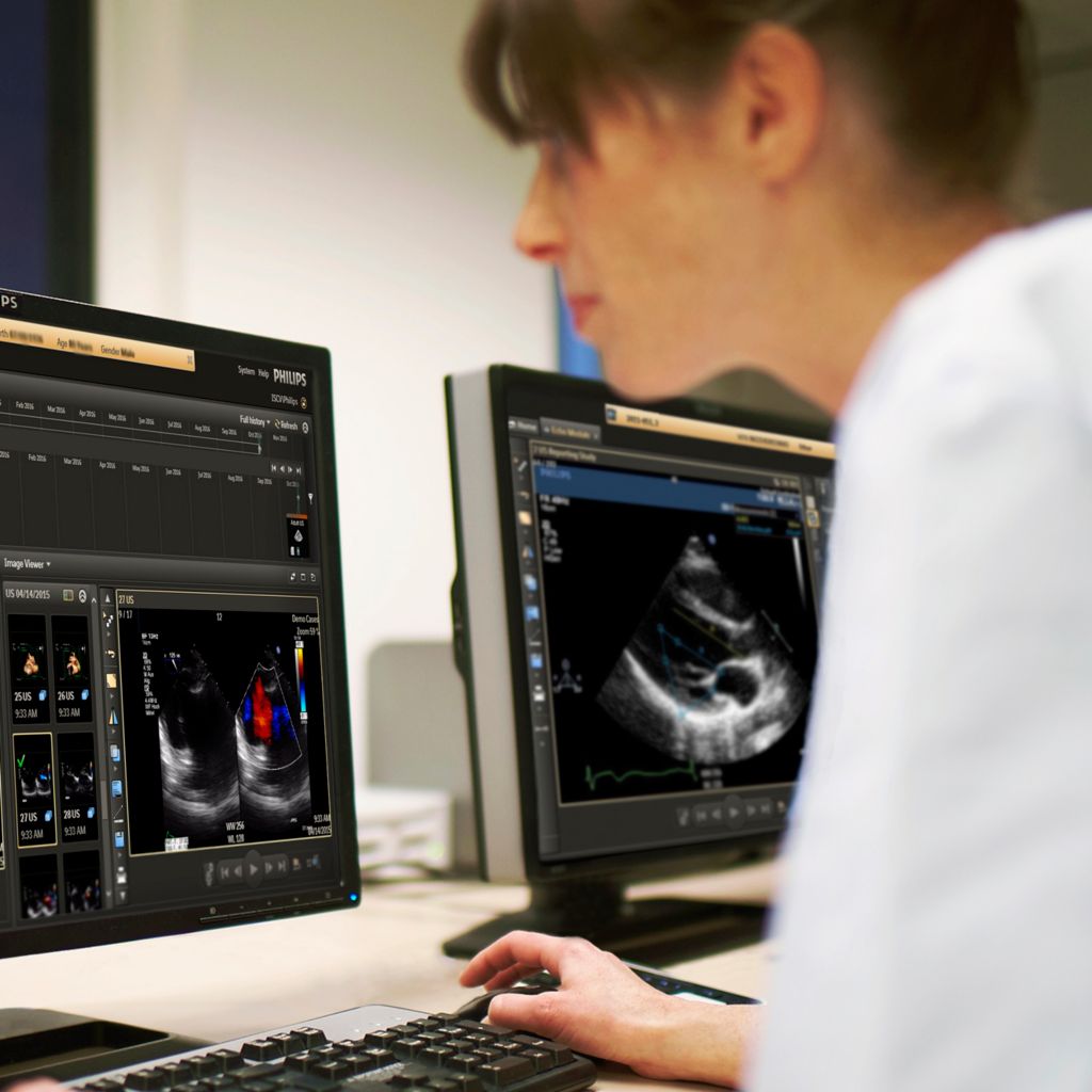 Care provider looking at a screen with cardiac procedure imaging