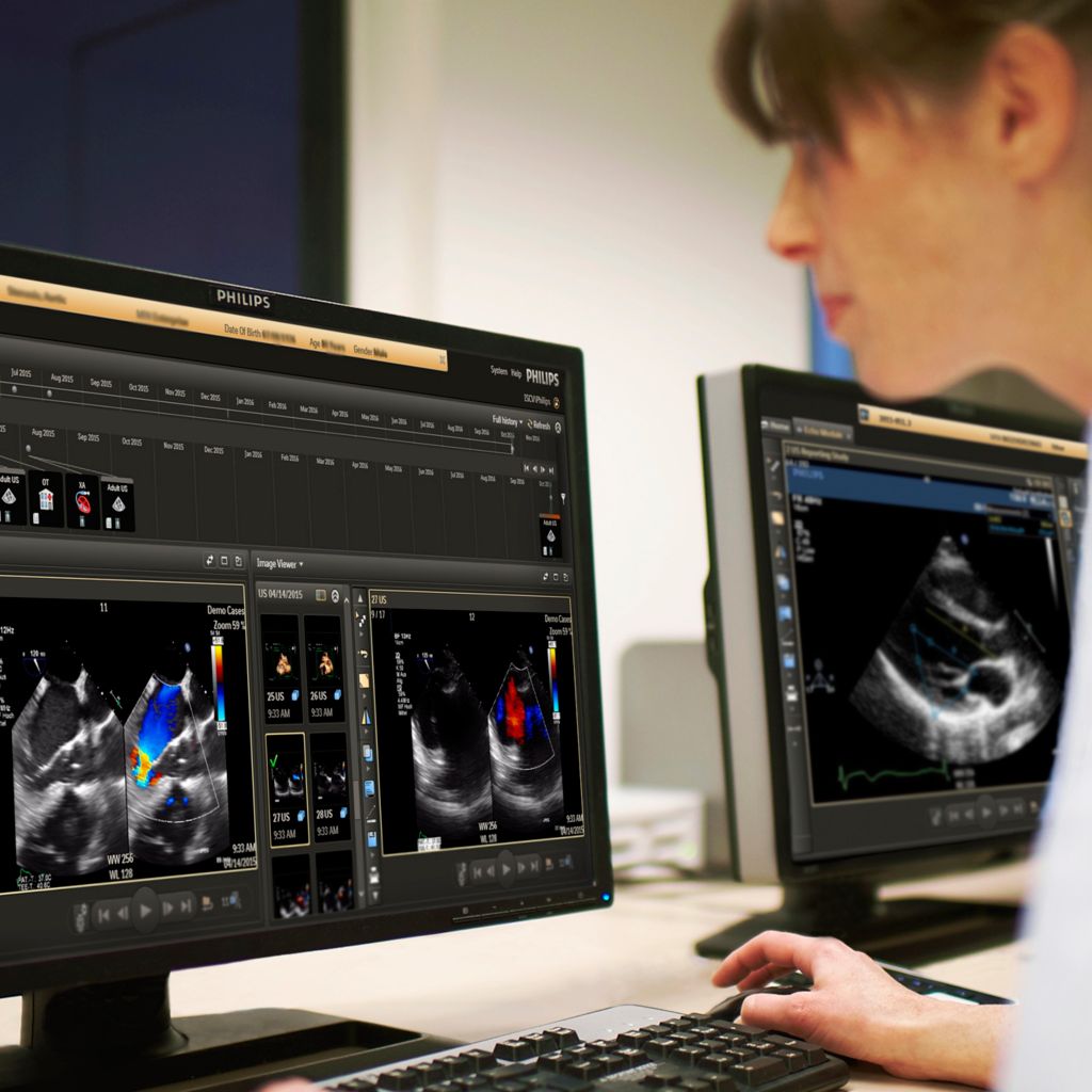 Care provider looking at a radiology imaging screen