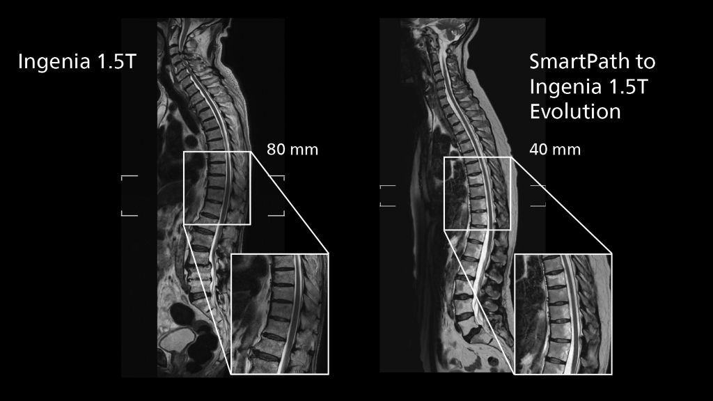 Total spine multi‐station imaging: comparing Ingenia 1.5 vs. SmartPath to Evolution 