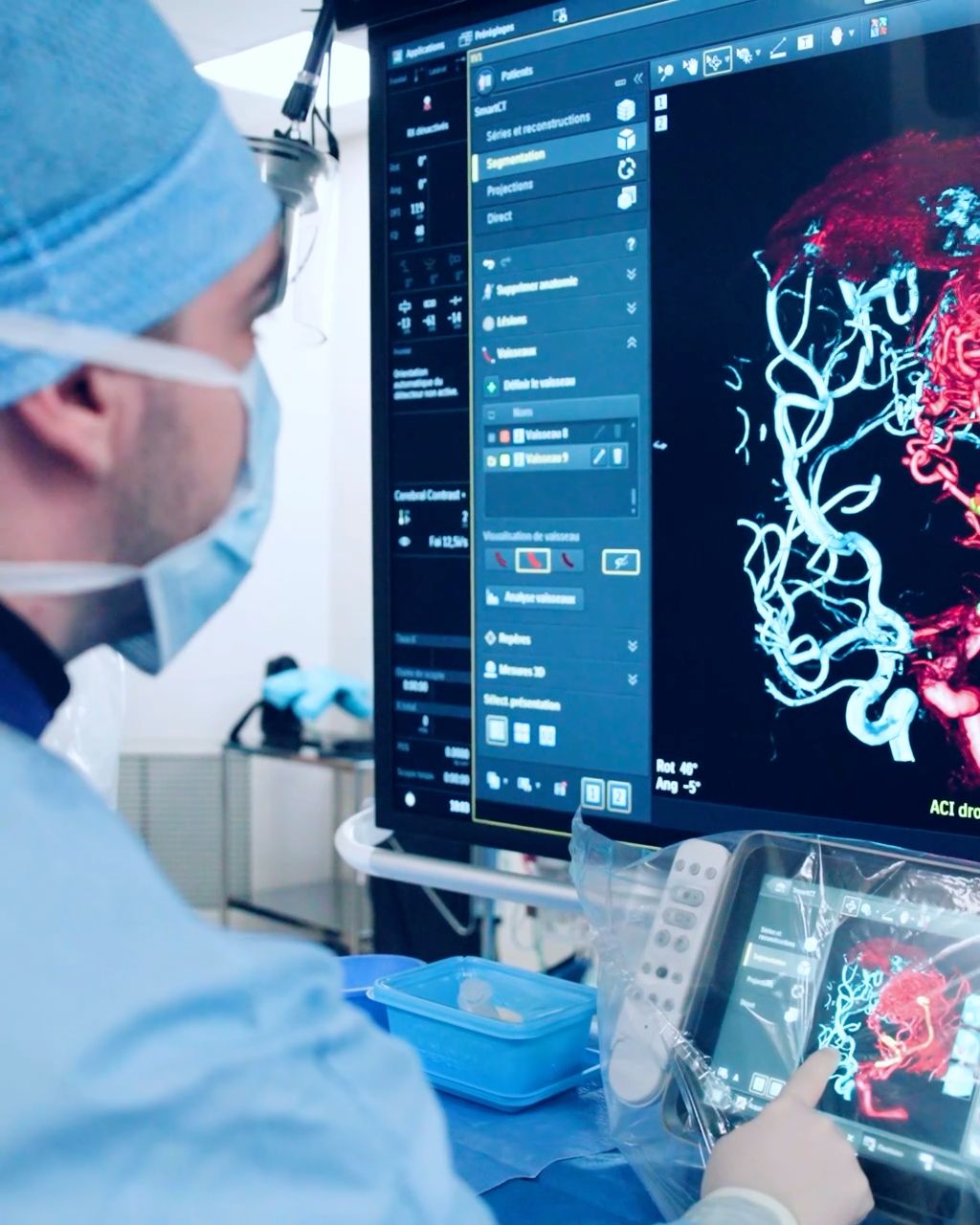 Interventional neuroradiologist in angio suite treating patients with image-guided therapy system
