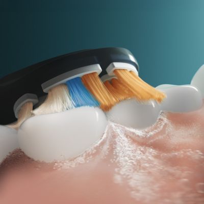 Anwenderbild Sonicare Bürstenkopf