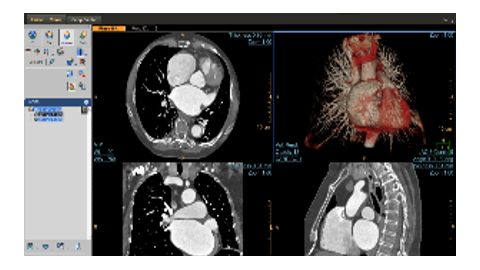 CT cardiac viewer