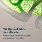 Essentiële reiniging voor gezonde tanden en gezond tandvlees