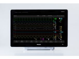 IntelliVue Active Display
