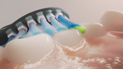 Proven Sonicare technology