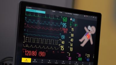 Sjukhusmonitor som visar vitalparametrar med patientavatar
