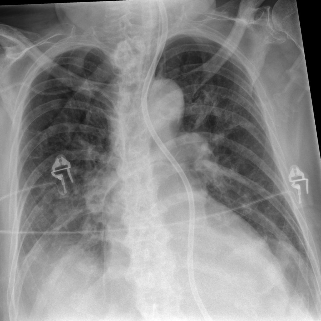 Chest Exam with Skyflow plus