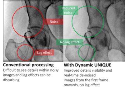 Temporal and spatial noise suppression