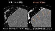 case 86
卵巣腫瘍の診断①