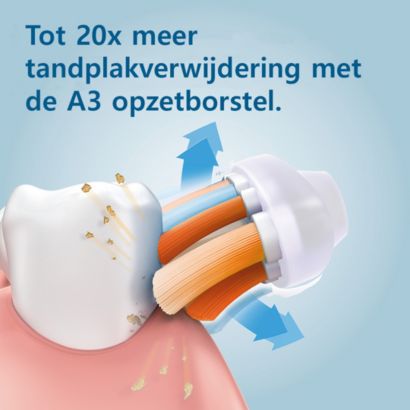 Tot 20x meer tandplakverwijdering met All-in-One-opzetborstel