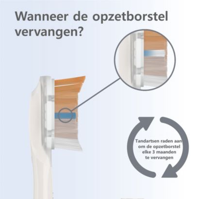 Eén opzetborstel voor complete verzorging