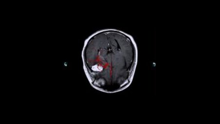 XperCT for CT-like imaging in the lab