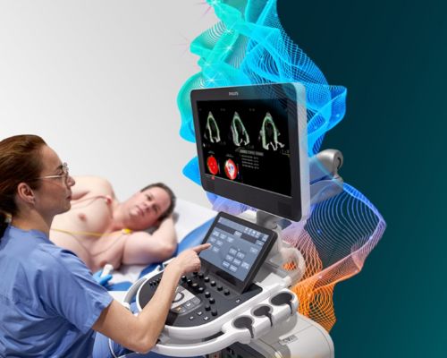 Campaign visual, Transcend, Affiniti CVx, CV Ultrasound