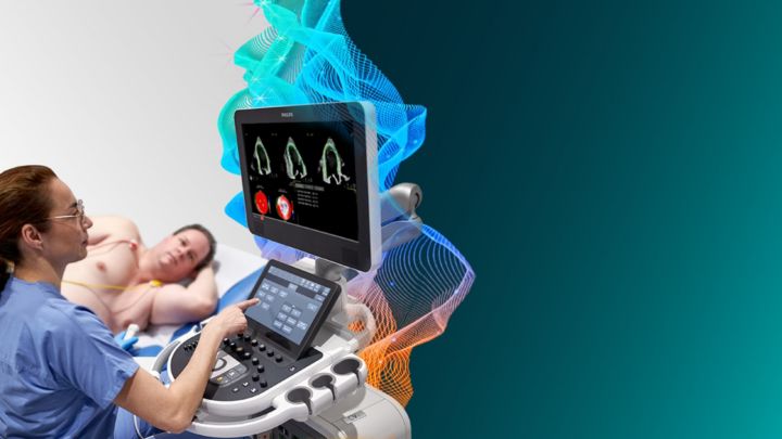 Philips EPIQ Ultrasound machine