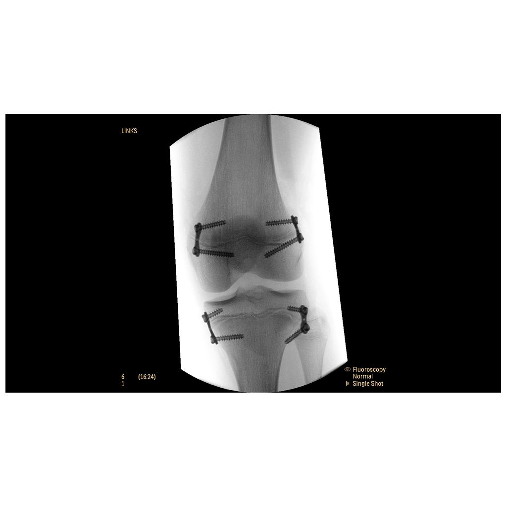 Enhanced imaging for metal objects