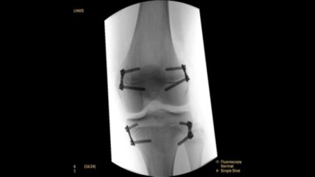 Enhanced imaging for metal objects