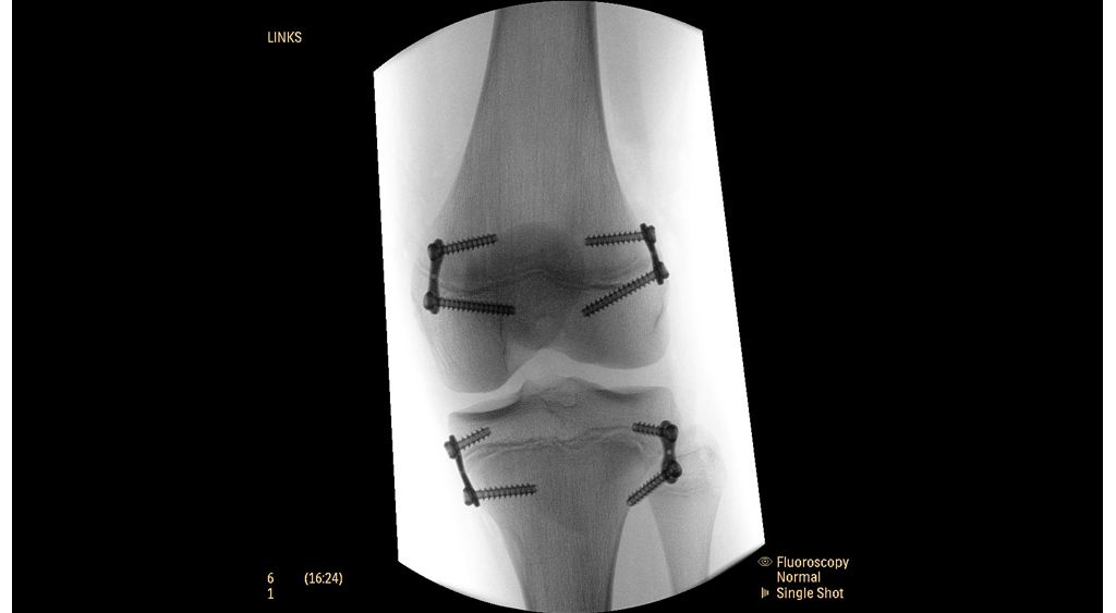 Enhanced imaging for metal objects