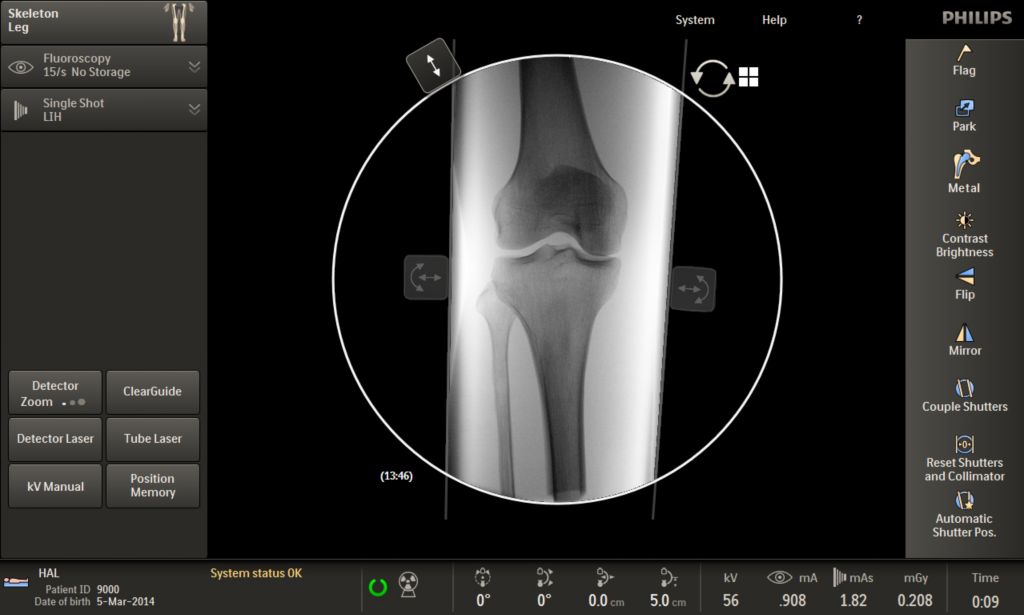 Clinical Image Philips Veradius Unity Mobile C-arm with Flat Detector