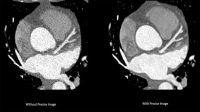 Vergelijking van Ct-scans: nauwkeurige beeldverbetering
