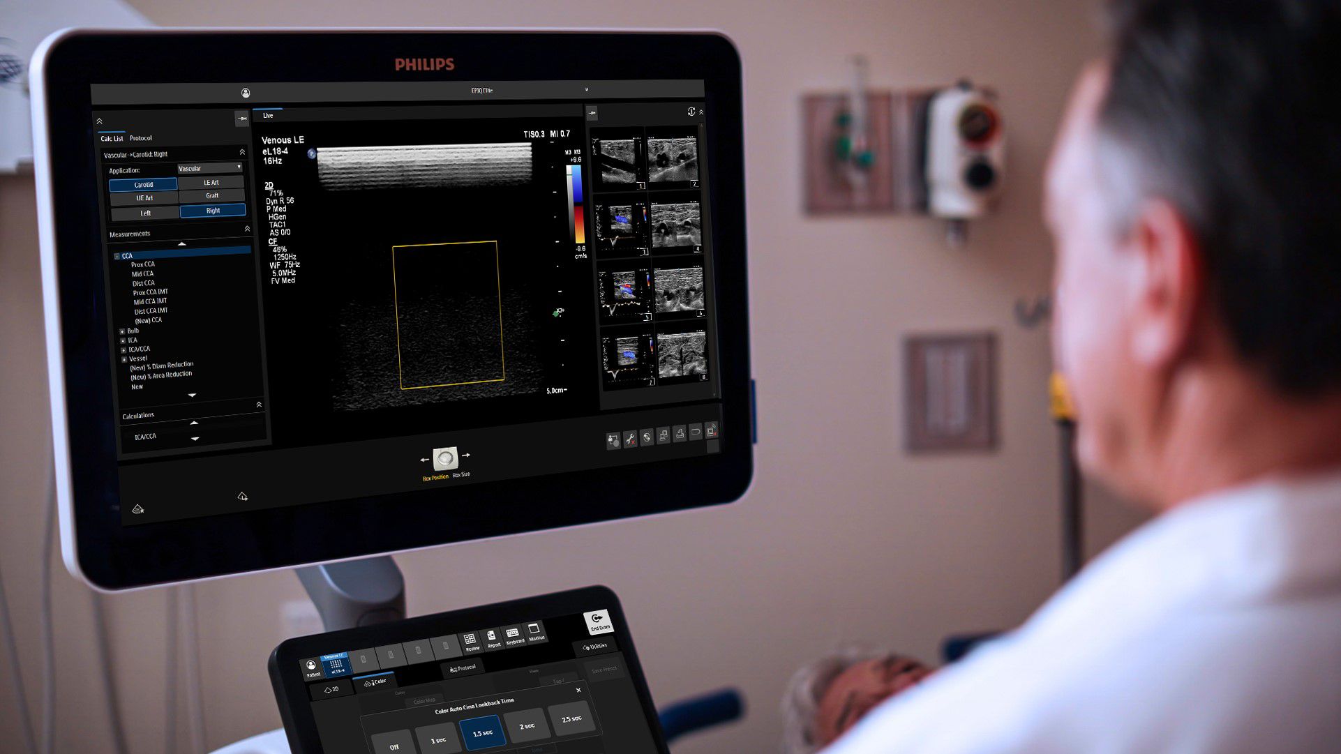 Clinician reading ultrasound screen
