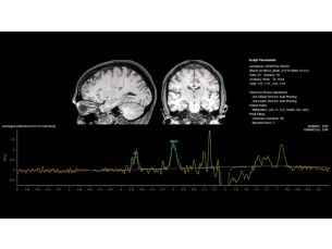 MEGA MR Clinical application