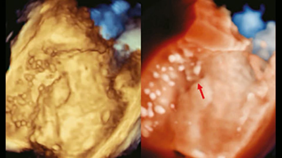 Clinical image - TrueVue