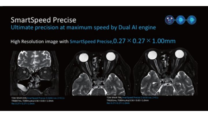 SmartSpeed Precise Imageを使用した眼窩領域画 像例　（画像提供：九州大学病院（MR 7700）） ※上記症例の結果は、他の症例の結果を予測するものではありません。他の症例の結果は異なる場合があります。