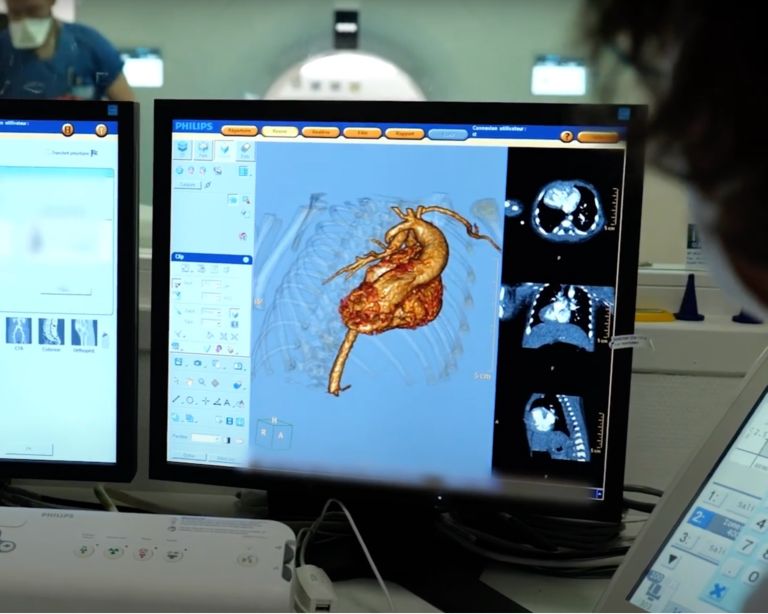 CT-System mit Spektraldetektor im Einsatz an den Hospices Civils de Lyon, Frankreich