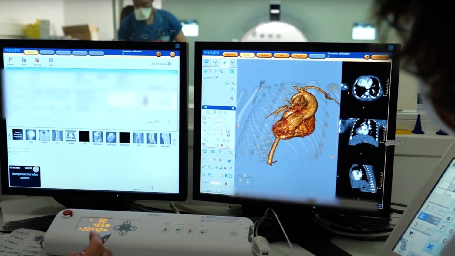 Clinicians at Hospices Civils de Lyon, France discuss the value of Philips spectral-detector CT in diagnosing patients.
