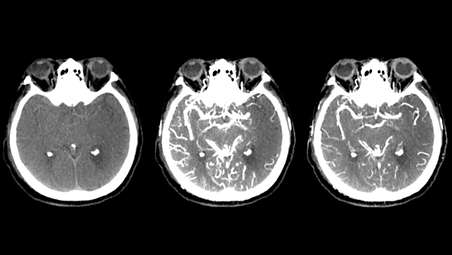 CBCT Dual in brain imaging