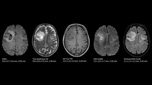 Brain exam with SWIp