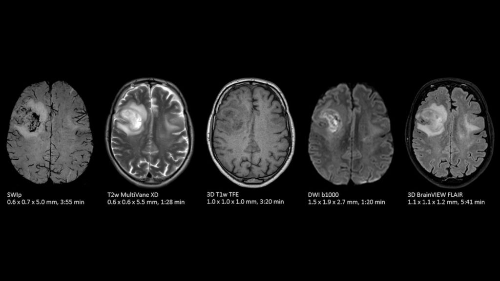 Brain exam with SWIp