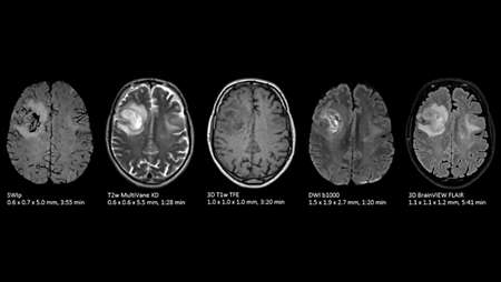 Brain exam with SWIp