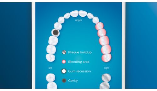 Pflegen Sie Problembereiche besser
