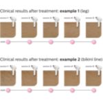 Feel continuously hair free*