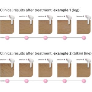 Feel continuously hair free*