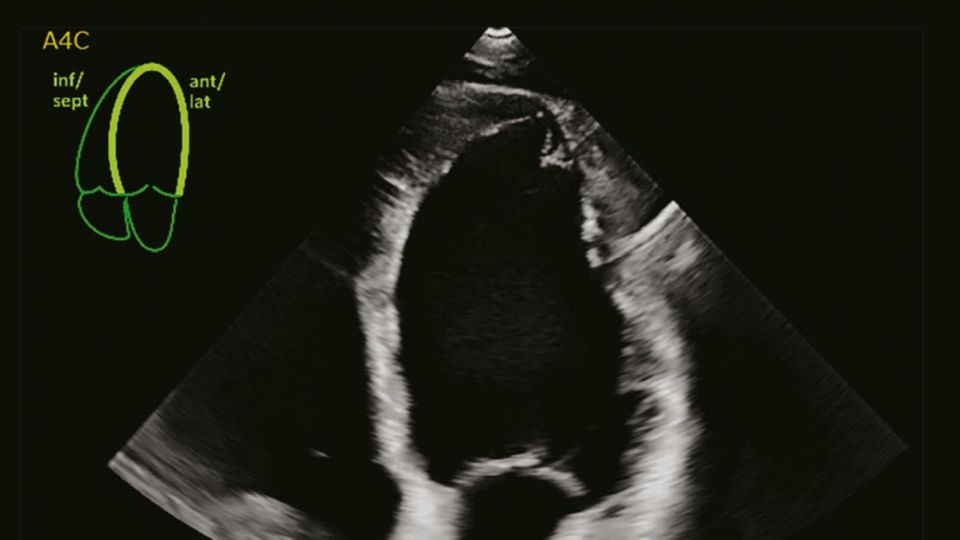 AutoStrain clinical image showing Auto View Recognition