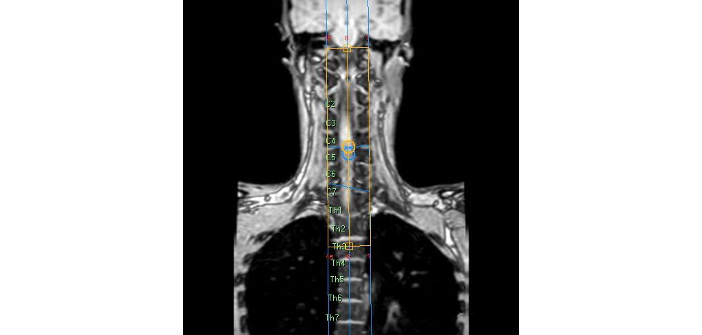 SmartExam Spine