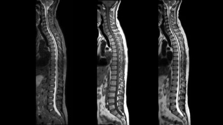 Wiarygodna diagnoza zależy od jakości uzyskanych obrazów
